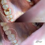 دکتر یلدا حاجی عباسی در رشت