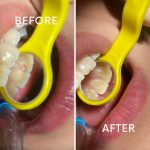 دکتر یلدا حاجی عباسی در رشت