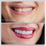 دکتر یلدا حاجی عباسی در رشت