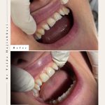 دکتر یلدا حاجی عباسی در رشت