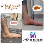 جراح پا و مچ پا در رشت