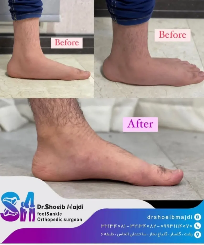 جراح پا و مچ پا در رشت