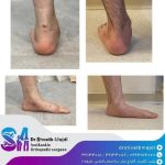 جراح پا و مچ پا در رشت