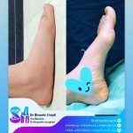 جراح پا و مچ پا در رشت