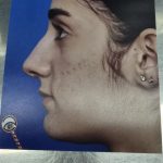 دکتر عادل ایمانی پرشکوه در رشت