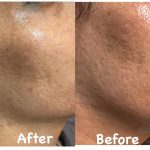 کلینیک پوست و زیبایی ابریشم در لنگرود