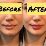 کلینیک پوست و زیبایی ابریشم در لنگرود