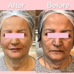 کلینیک پوست و زیبایی ابریشم در لنگرود