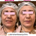 کلینیک پوست و زیبایی ابریشم در لنگرود