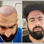 دکتر مهرداد رضا برزیگر در رشت