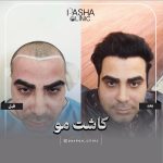 دکتر مهرداد رضا برزیگر در رشت