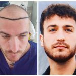 دکتر مهرداد رضا برزیگر در رشت