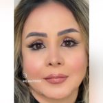 دکتر بهرام بادامچی در تهران