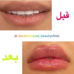 مرکز زیبایی دکتر نادیا توکلی نژاد در کرمان