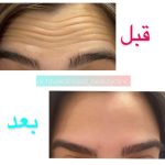 مرکز زیبایی دکتر نادیا توکلی نژاد در کرمان