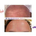 مرکز زیبایی دکتر نادیا توکلی نژاد در کرمان