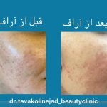 مرکز زیبایی دکتر نادیا توکلی نژاد در کرمان