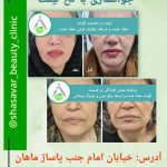 دکتر لادن حسنی در تنکابن