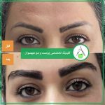 دکتر لادن حسنی در تنکابن