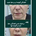 دکتر لادن حسنی در تنکابن