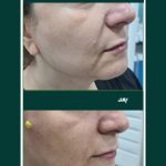 دکتر لادن حسنی در تنکابن