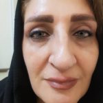 دکتر علیرضا علیجانی در کرج