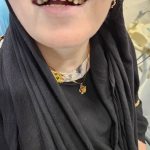 دکتر محمد علی عالمی در مشهد