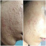 مرکز تخصصی پوست و مو الین در تهران