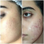 مرکز تخصصی پوست و مو الین در تهران