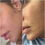 مرکز تخصصی پوست و مو الین در تهران