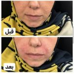 دکتر آذر اکبرنژاد در اهواز