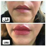 دکتر آذر اکبرنژاد در اهواز