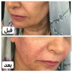 دکتر آذر اکبرنژاد در اهواز