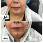 دکتر آذر اکبرنژاد در اهواز