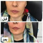 دکتر آذر اکبرنژاد در اهواز