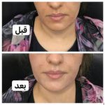 دکتر آذر اکبرنژاد در اهواز