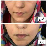 دکتر آذر اکبرنژاد در اهواز