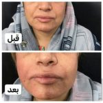 دکتر آذر اکبرنژاد در اهواز