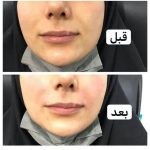 دکتر آذر اکبرنژاد در اهواز
