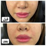 دکتر آذر اکبرنژاد در اهواز