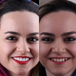 دکتر الهام فریدی در تهران