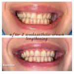 دکتر مائده پورنصیر در رشت