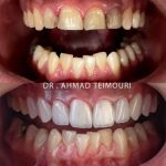 دکتر احمد تیموری در دزفول