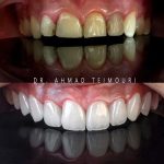 دکتر احمد تیموری در دزفول