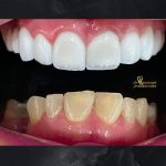 دکتر احمد تیموری در دزفول