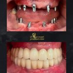 دکتر احمد تیموری در دزفول