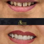 دکتر احمد تیموری در دزفول