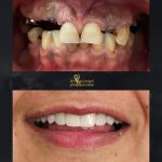 دکتر احمد تیموری در دزفول