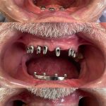 دکتر احمد تیموری در دزفول