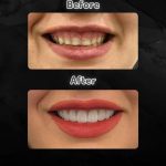 دکتر احمد تیموری در دزفول